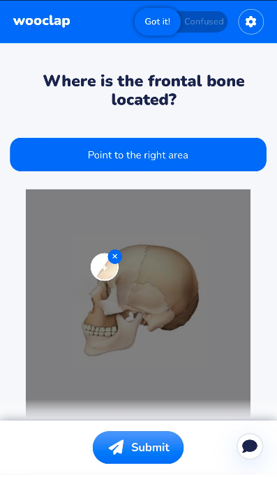 The screenshot displays the question "Where is the frontal bone located" on the top, followed by a button saying "Point to the right areas". An image of a human skull is displayed below, and a circle pinpoint is put on the upper left of the skull. There's a Submit button on the bottom of the screen.